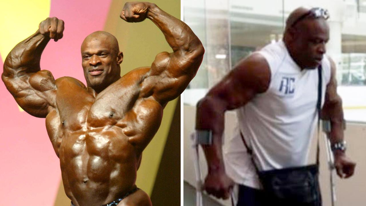 What Happened to Ronnie Coleman
