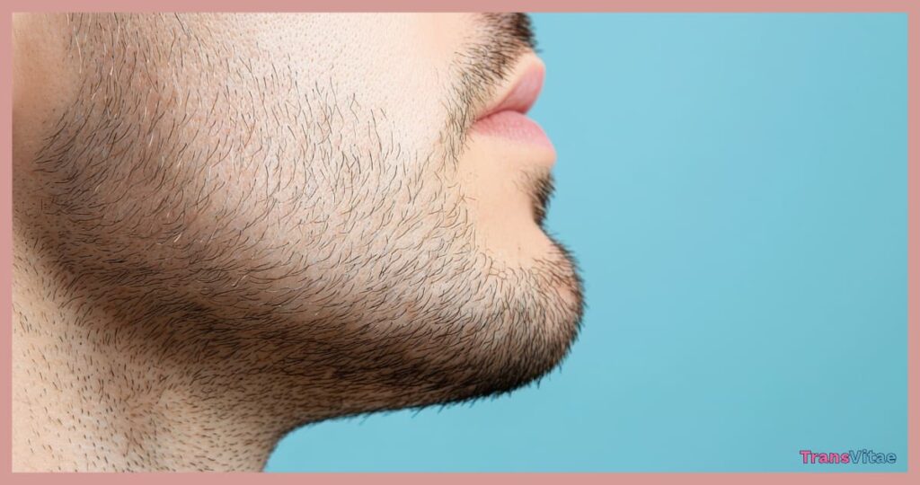 Minoxidil FTM